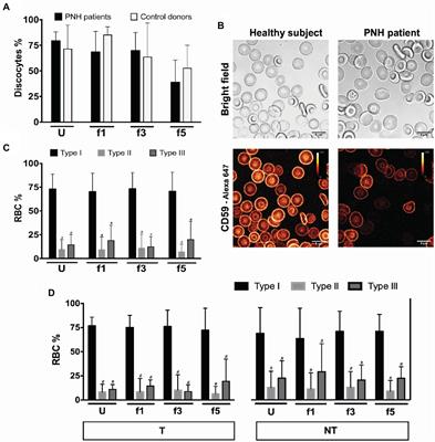 Red Blood Cell Homeostasis and Altered Vesicle Formation in Patients With Paroxysmal Nocturnal Hemoglobinuria